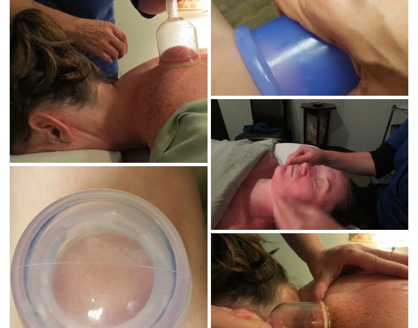 medicupping and massage cupping
